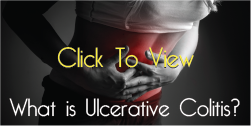 What is ulcerative colitis?